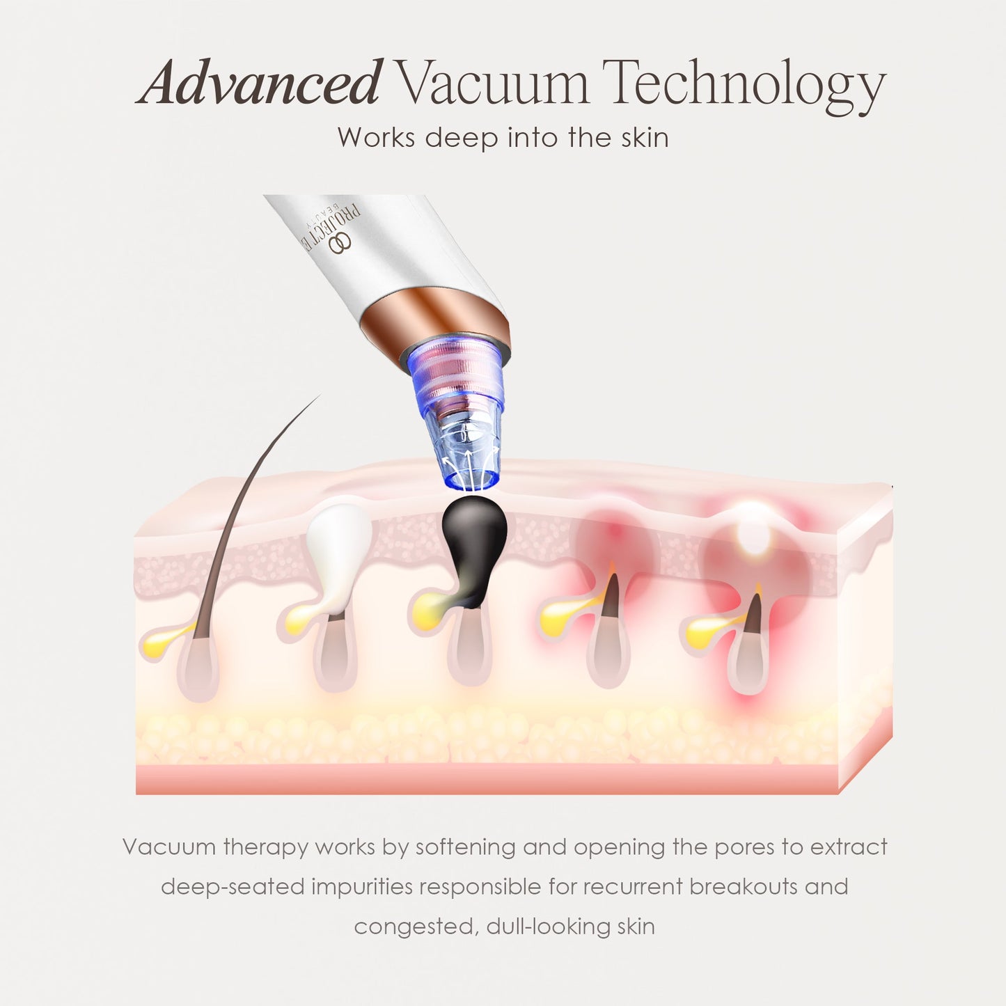 Blackhead/Pore  Vacuum