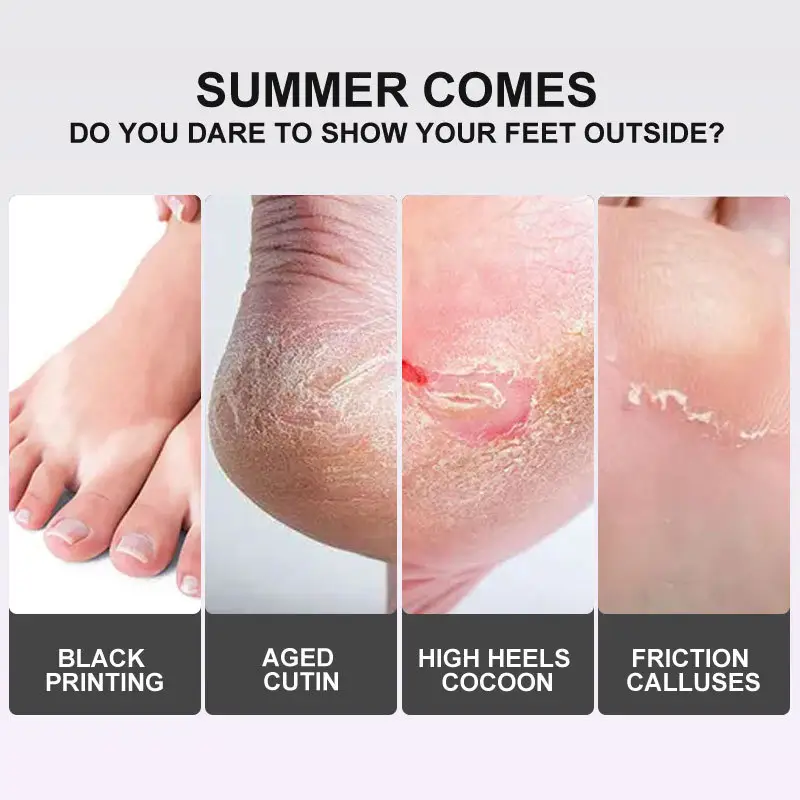 Exfoliating Foot Peel Mask