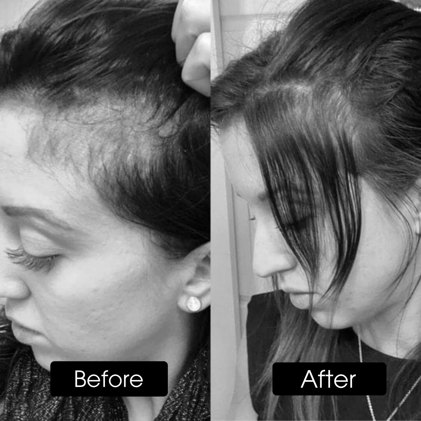 4 in 1 Hair Therapy Brush